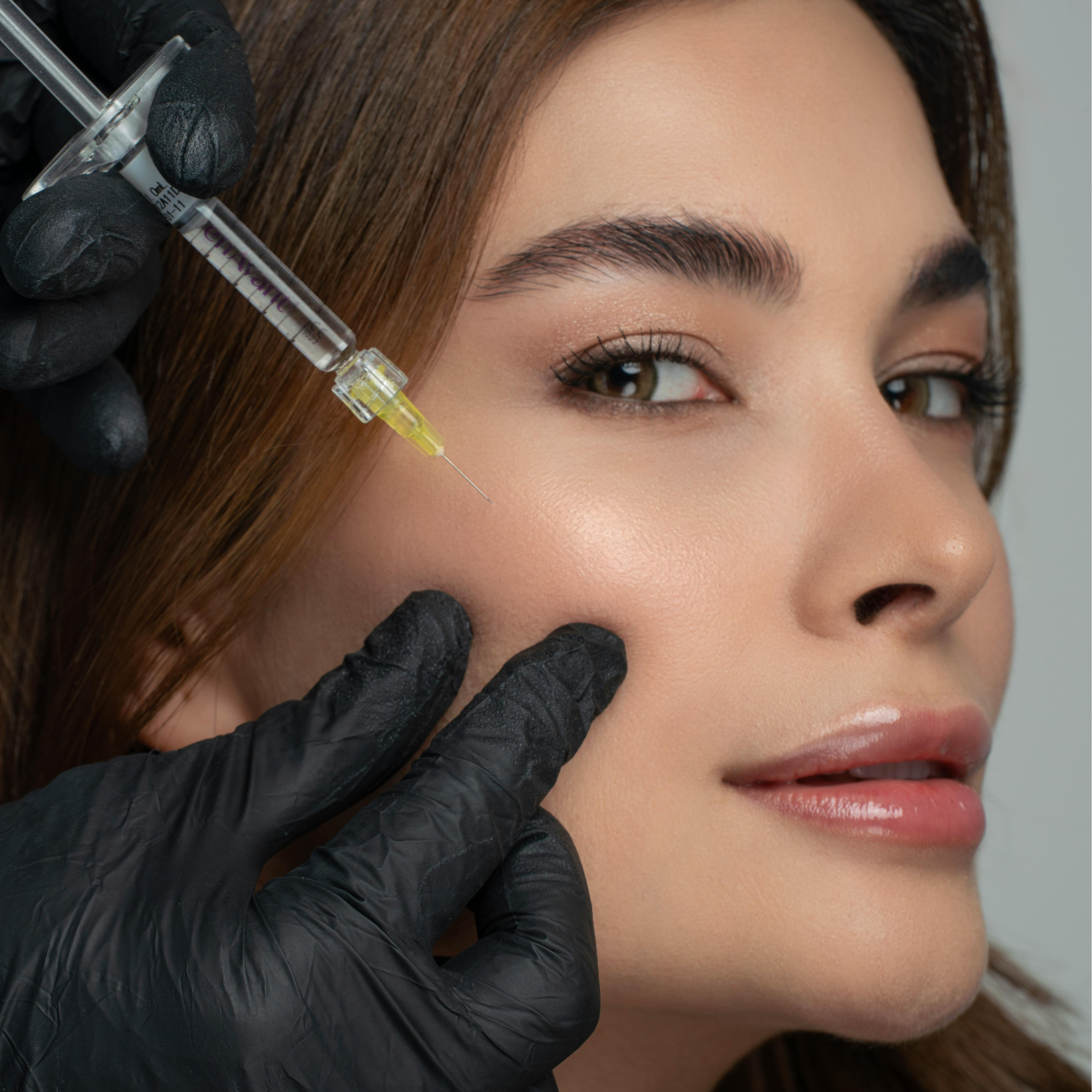 Cheek Filler South Dublin, Stillorgan