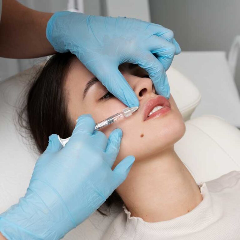 Practitioner injecting dermal filler into a patients upper lip