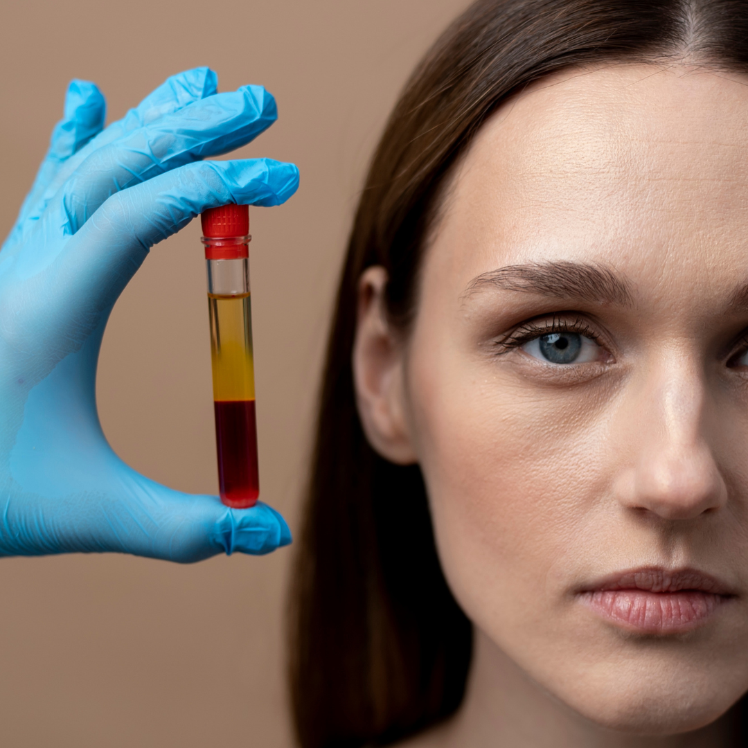 PRP Vampire Facial-PRP Face treatment- PRP Facelift- PRP Treatment in Dublin