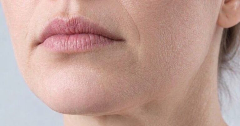 Dry Skin Treatments in Dublin: How to Improve Skin Hydration