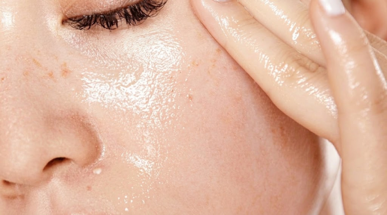 Oily Skin Treatment in Dublin: Personalised Skincare & Professional Treatments